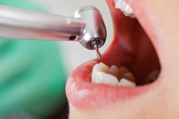 Best Dentist for Tooth Abscess  in Greenville, NC